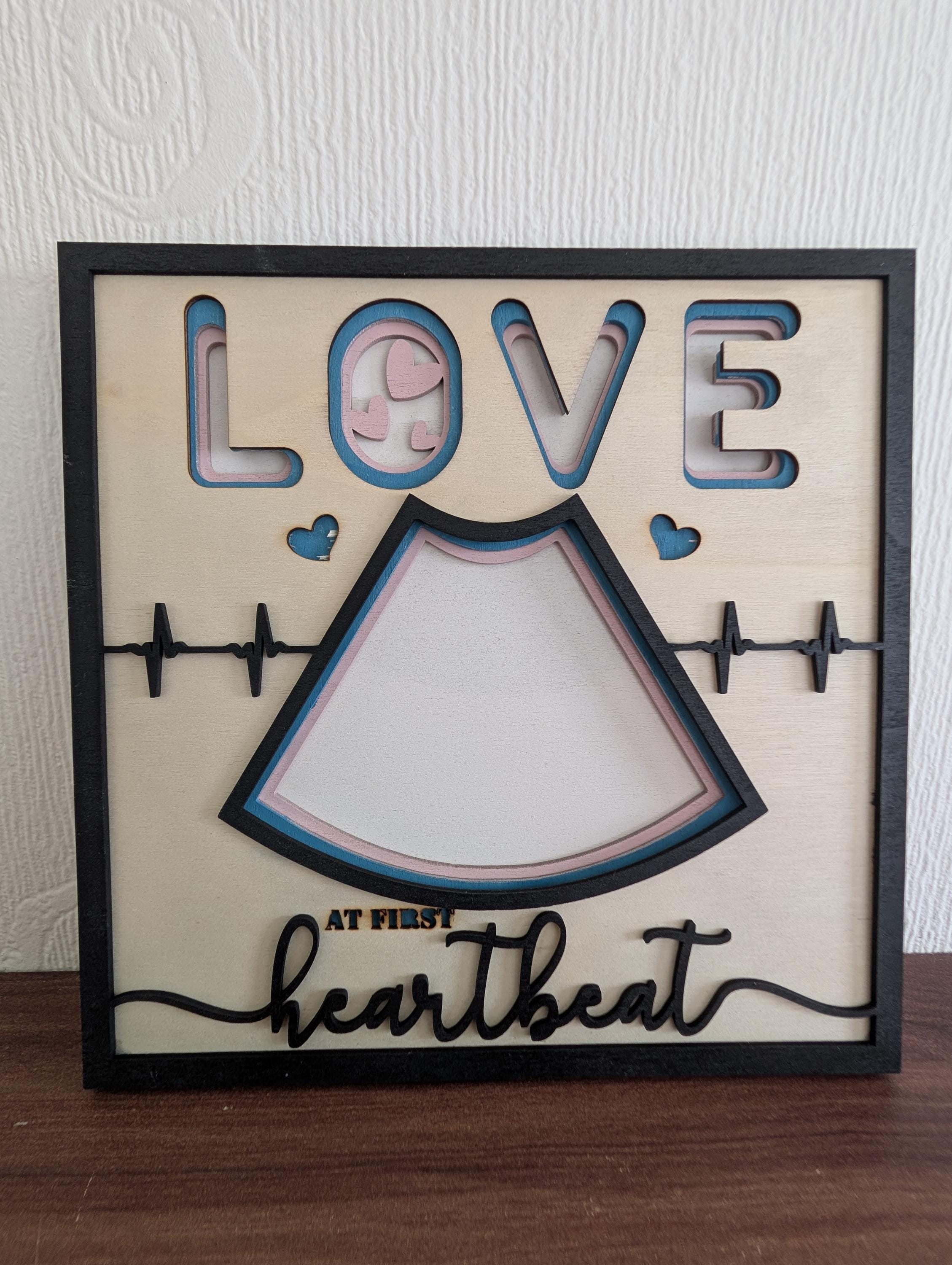 Personalized Baby Scan Frame – Laser Cut Ultrasound Photo Keepsake